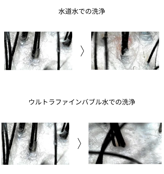 scalp-cleaning