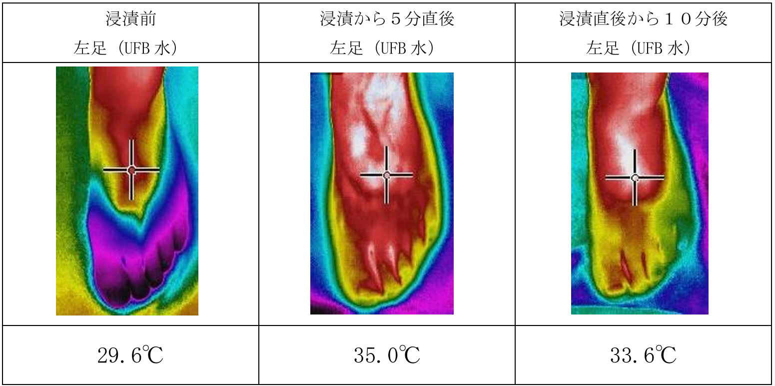 skin-temperature-thermography-ufb